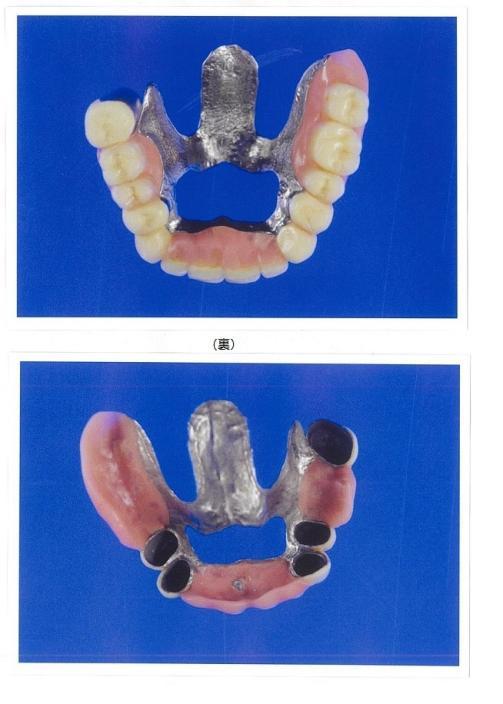 死者の所持品の写真